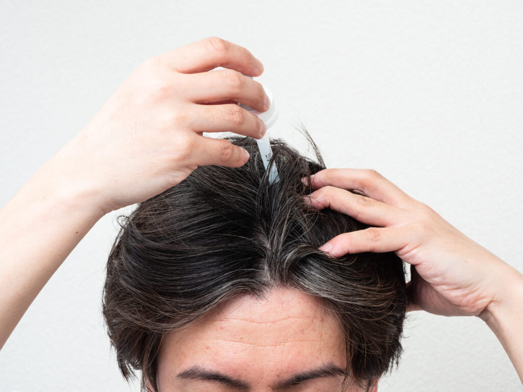 ダーマローラー育毛効果なし