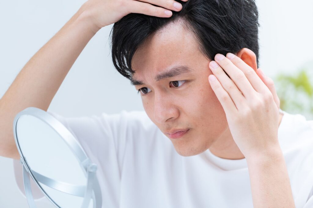ダーマローラー　育毛