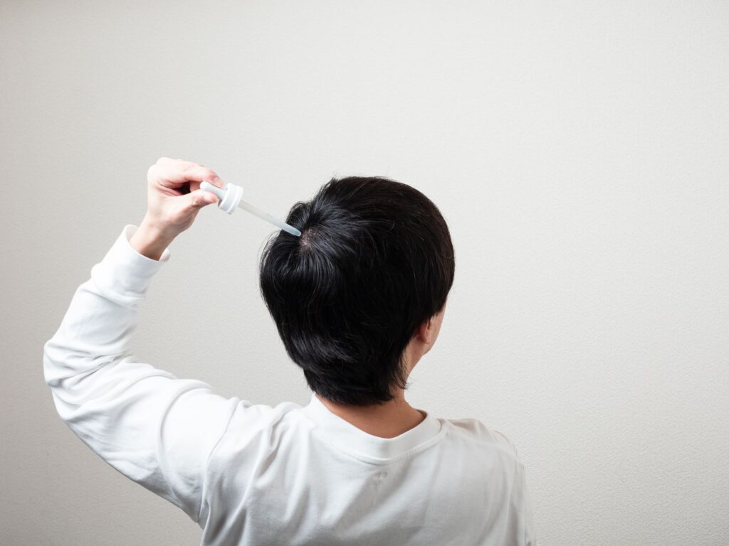 AGA 育毛剤