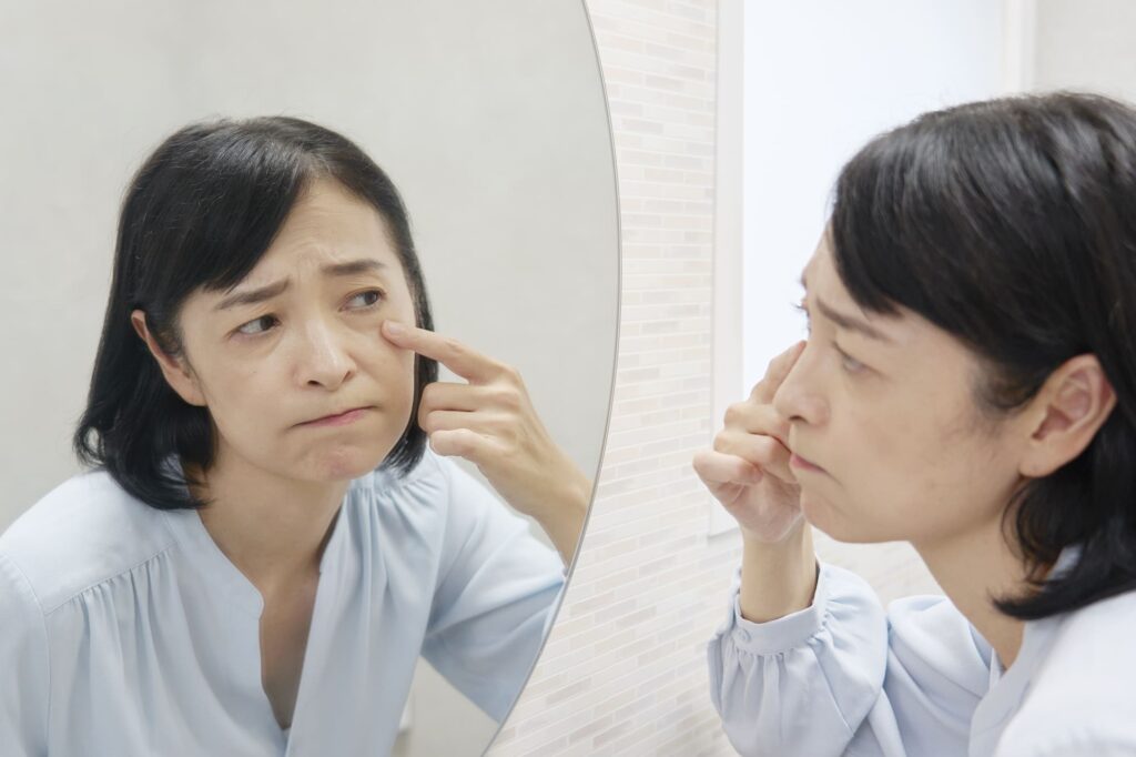 毛穴 たるみ